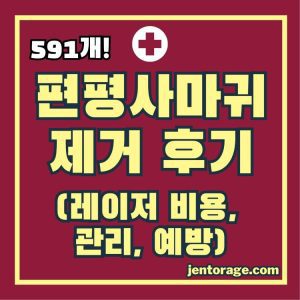 편평사마귀 제거 후기